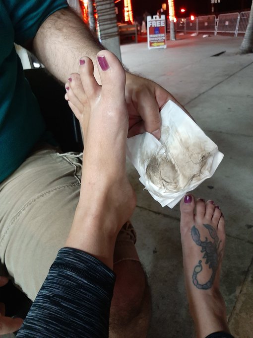 Had a flipflop blow out😫 https://t.co/DaWzwXHrCi<a href="/tag/softsoles"class="tags"><span>#softsoles</span></a><a href="/tag/harrybush"class="tags"><span>#harrybush</span></a>