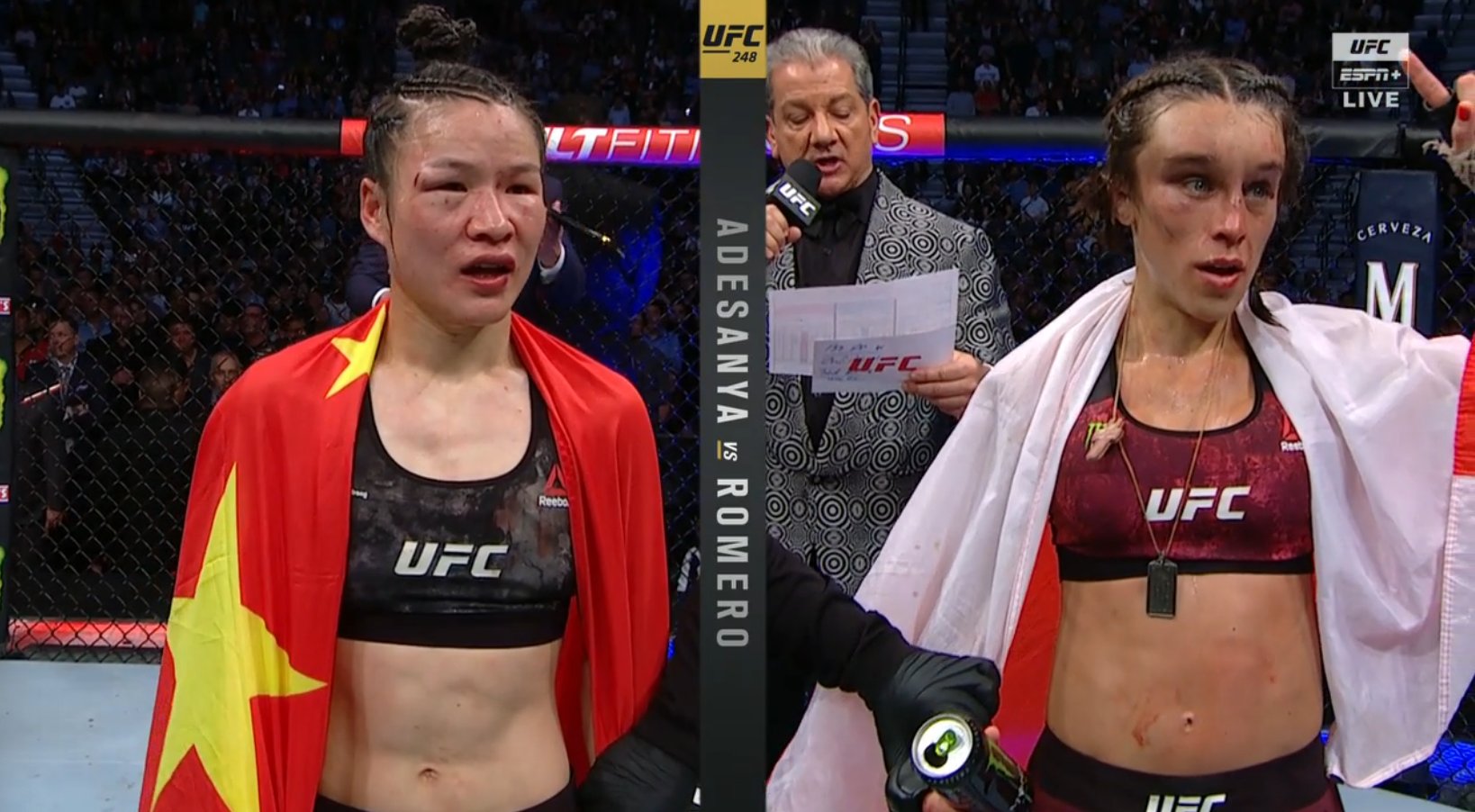 (PIC) Joanna Hematoma | Sherdog Forums | UFC, MMA & Boxing ...