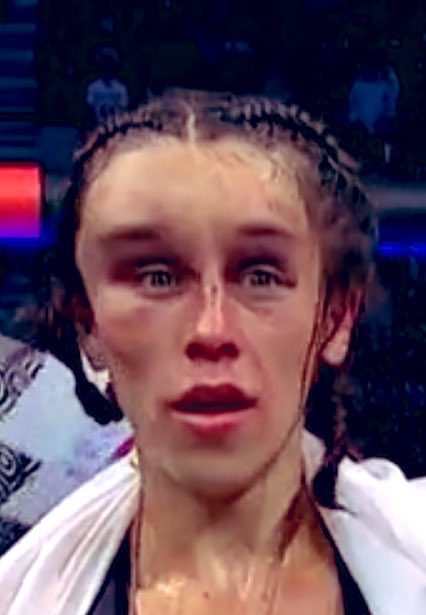 SharpFootball's tweet photo. The same fighter before &amp; after a title fight https://t.co/JZDt4pLXNj