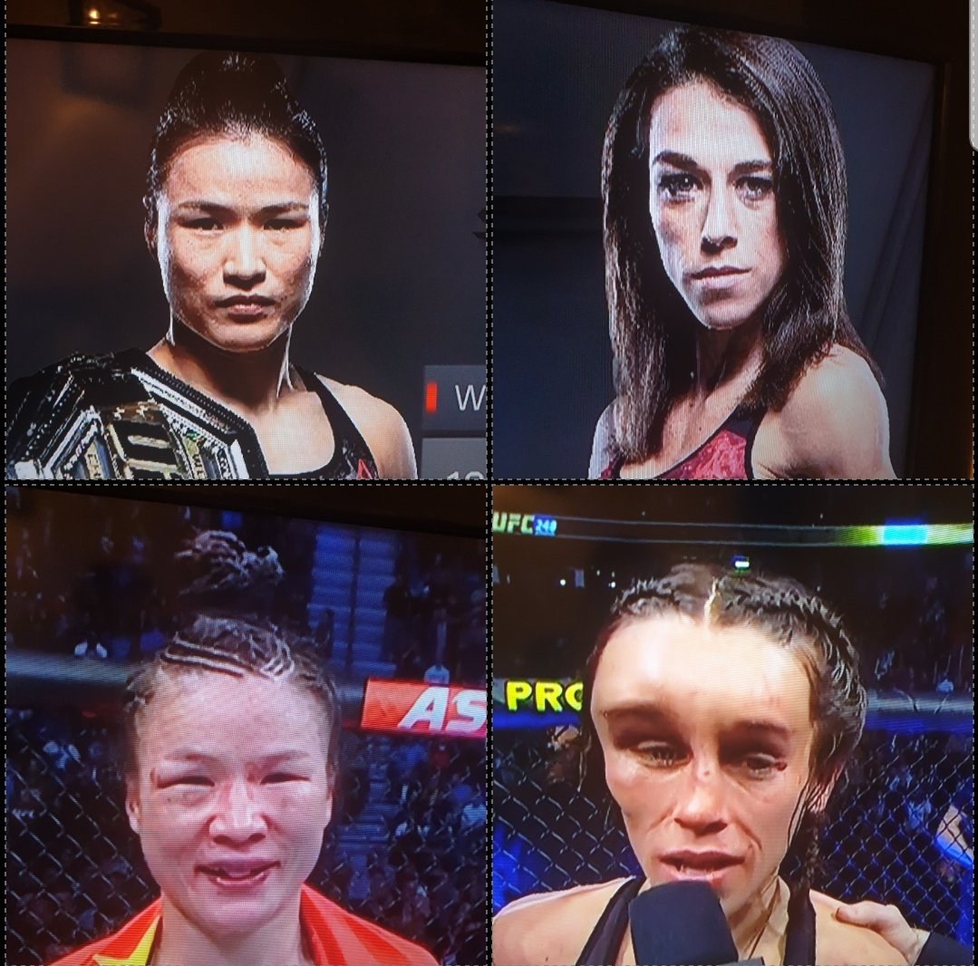 WHAT A FIGHT! One of the best fights I've ever watched, well done to both women.

The before and after is not cooooool. 😂😂😂😂
#UFC248
