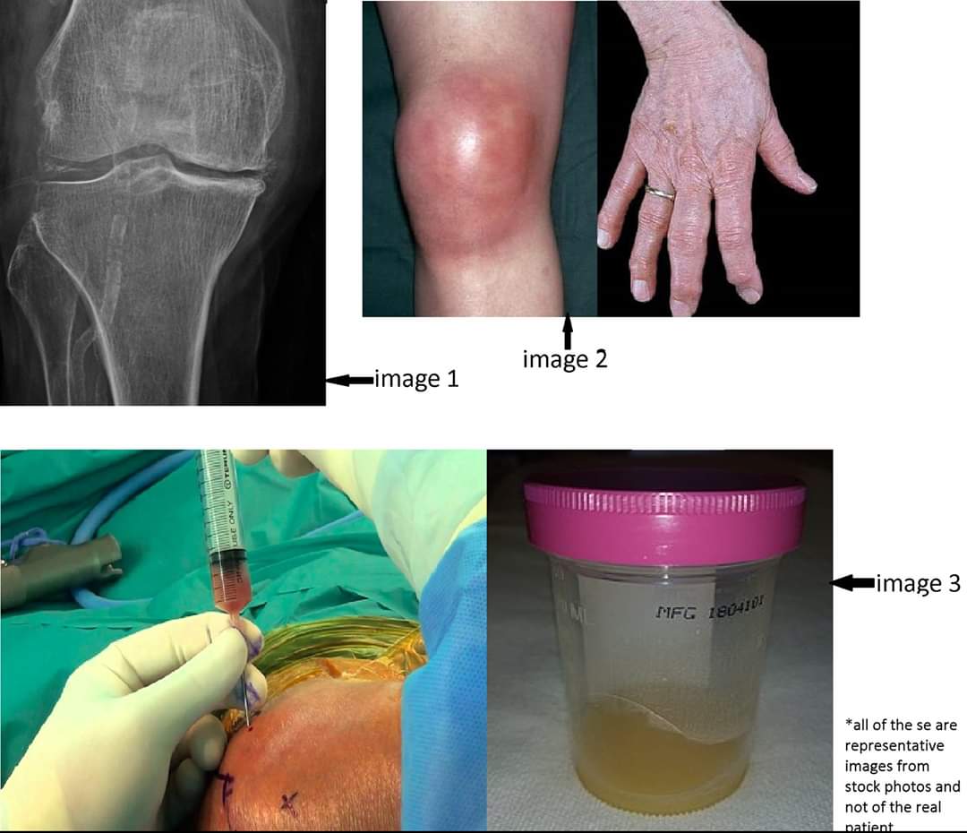 ira_karnataka's tweet image. Nobody answered the question correctly till now!!! U have 1 more week. Pl. forward to ur friends and let’s see who succeeds.#smartpants challenge. As a bonus, marks are doubled. 20 for 1st correct answer and and 4 for any right answer.
irakarnataka.org/quiz/