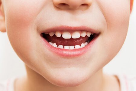 سن لبني 🦷 tweet media