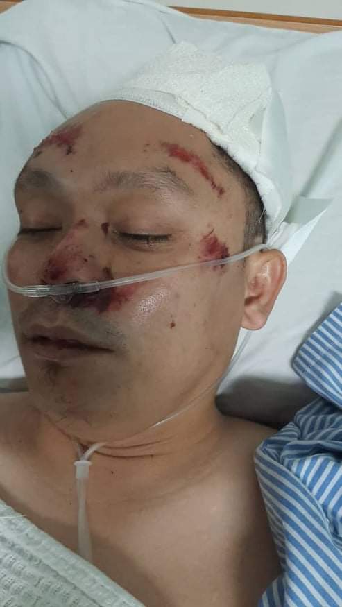 AsalGombak's tweet photo. SAKSI KEMALANGAN LANGGAR LARI DICARI

Sekitar pukul 1 pagi tadi, satu kemalangan langgar lari berlaku di MRR2 berhampiran Taman Layang-Layang dari arah Kepong ke Batu Caves.

Bagi sesiapa yang telah menjadi saksi atau ada info, sila laporkan ke Balai Polis berhampiran atau waris. https://t.co/JBEZRFMrWl
