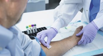 شركة Qiagen الألمانية تخترع  اختبار  "تست" لمرض #كورونا تظهر نتيجته في أقل من ساعة وبدقة متناهية
في الوقت الذي تتكبد فيه أغلب شركات العالم الخسائر 
ارتفعت أسهم الشركة 25% بعد أن اشترت دول كثيرة منها الصين التست
مقر الشركة موجود في منطقة هيلدن بالقرب من #دوسلدورف 
#صنع_في_المانيا