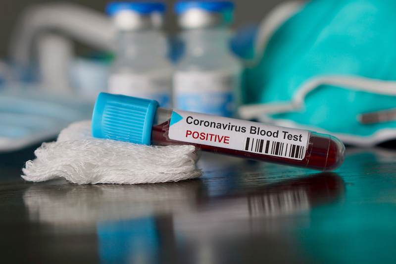 amar_sidhu_TO's tweet photo. Receiving questions about coronavirus? Here's a few tips to combat the misinformation and prepare for the possibility of mass absenteeism. https://t.co/6VeoxZK0fX https://t.co/nNW6XQNS1S