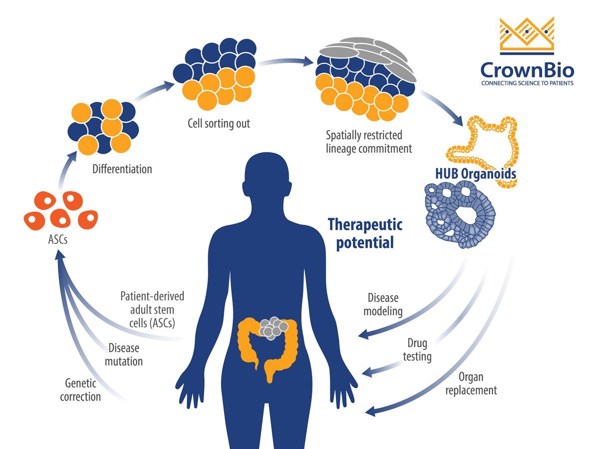 crownbioscience's tweet image. #oncologyblog: Explore how #tumororganoids helped uncover mechanisms behind #colorectalcancer buff.ly/2Pnwbdi #HUBorganoids
