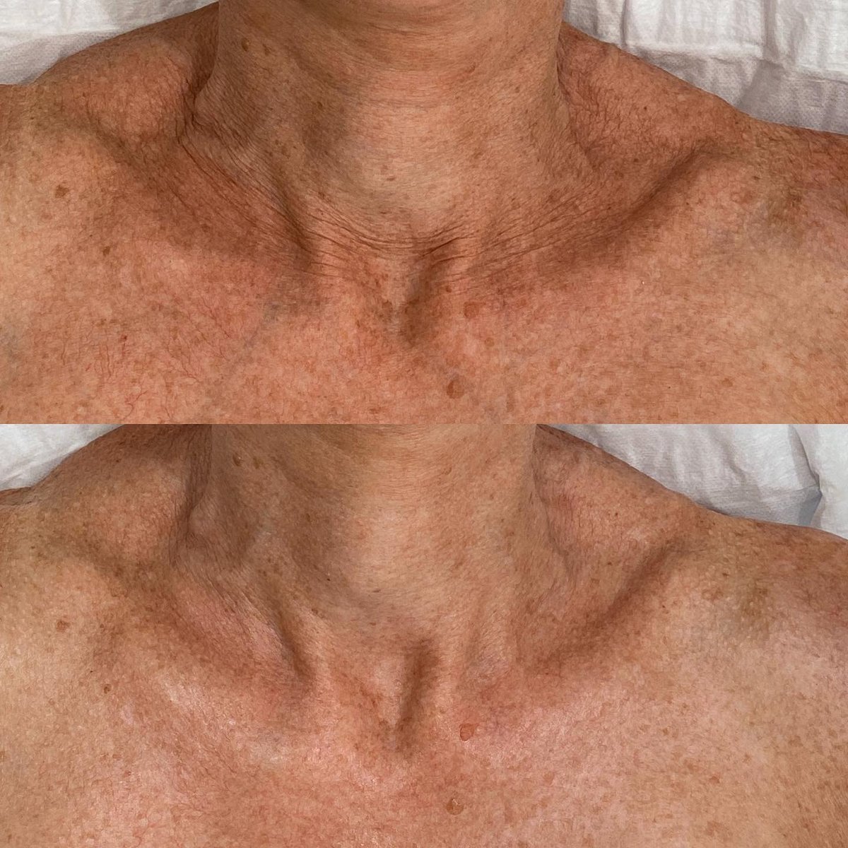 Dermasweep tweet media