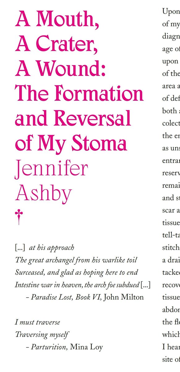 JenniferAAshby's tweet photo. Just read through the proofs of my article for @ache_magazine - was a bit emotional! The issue has gone to print & will be launched on March 25th (which also happens to be my birthday). Pre-orders available!
#AcheMagazine #IBD #Colitis #JPouch #Stoma #ChronicIllness #NoColon https://t.co/QgU5dKxqXT