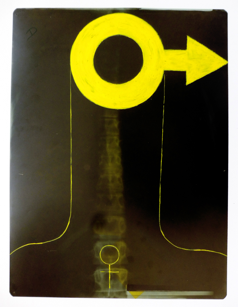 stephane_art's tweet photo. Série "Déchets humains"
Radiographies humaines, gouache jaune primaire et blanche, plastification

#jaune #yellow #amarillo #peinture #paint #pintura #dessin #drawing #recyclage #recycling #déchetshumains #radiographie #radiography #radiographicart #artwork #rennes #stephane_art https://t.co/fFoOBdkF1Y