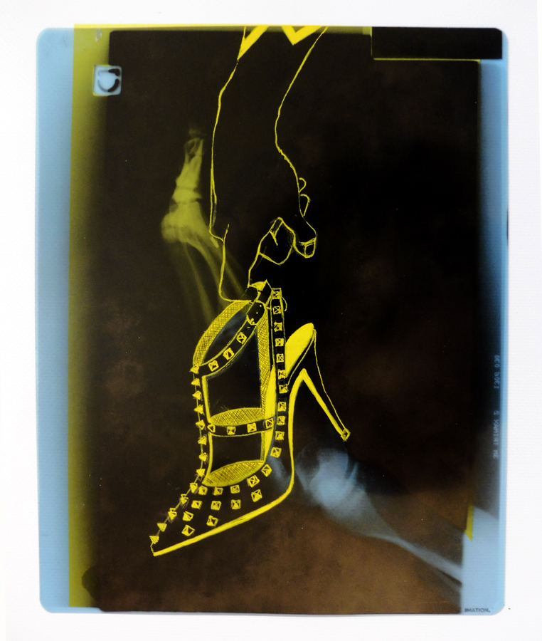 stephane_art's tweet photo. Série "Déchets humains"
Radiographies humaines, gouache jaune primaire et blanche, plastification

#jaune #yellow #amarillo #peinture #paint #pintura #dessin #drawing #recyclage #recycling #déchetshumains #radiographie #radiography #radiographicart #artwork #rennes #stephane_art https://t.co/fFoOBdkF1Y