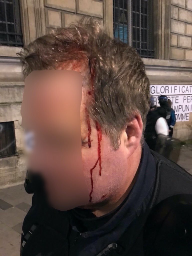 JulietteAlpha17's tweet photo. À ceux qui justifient ces slogans, qui s'offusquent d'une charge policière et qui crient aux violences illégitimes sur des "pauvres femmes sans défense", voilà un #Policier gradé qui a subi les violences et exactions de la part de ces "manifestantes pacifiques".

#marchefeministe https://t.co/98DBBfOWQU