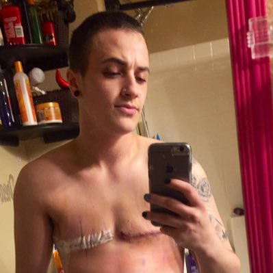AlexHankins13's tweet photo. #NewProfilePic #2weekspostop #Teetdelete https://t.co/0xq8HXnhpv