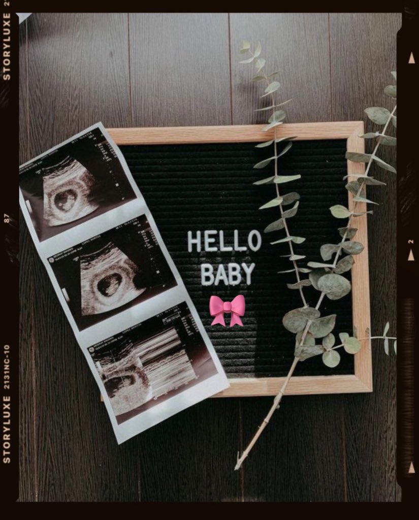 elenoirecaltier's tweet photo. one is great, two is fun, so why not ad another one?

we are expecting a baby girl 🎀 https://t.co/KAo4Jg4MP8
