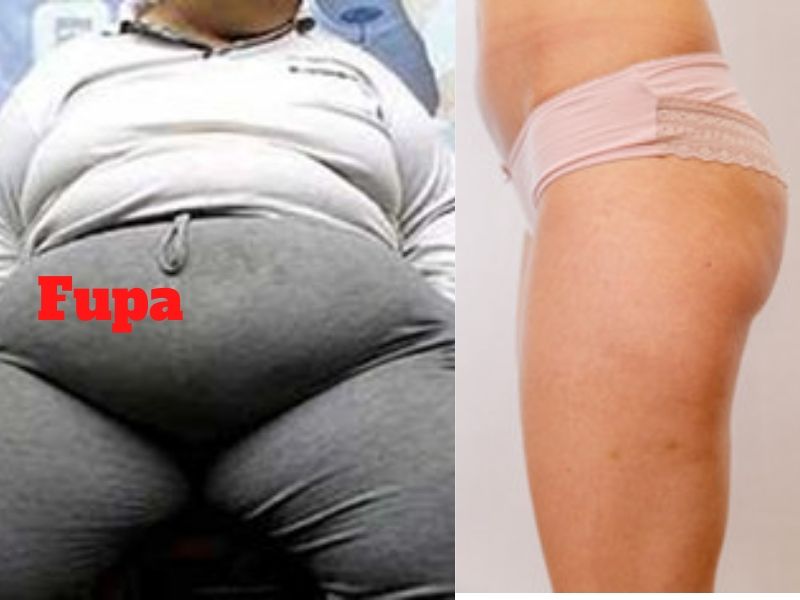#fupa. pubic-fat. findyourpills.net/how-to-get-rid-of. #pubicfat. 