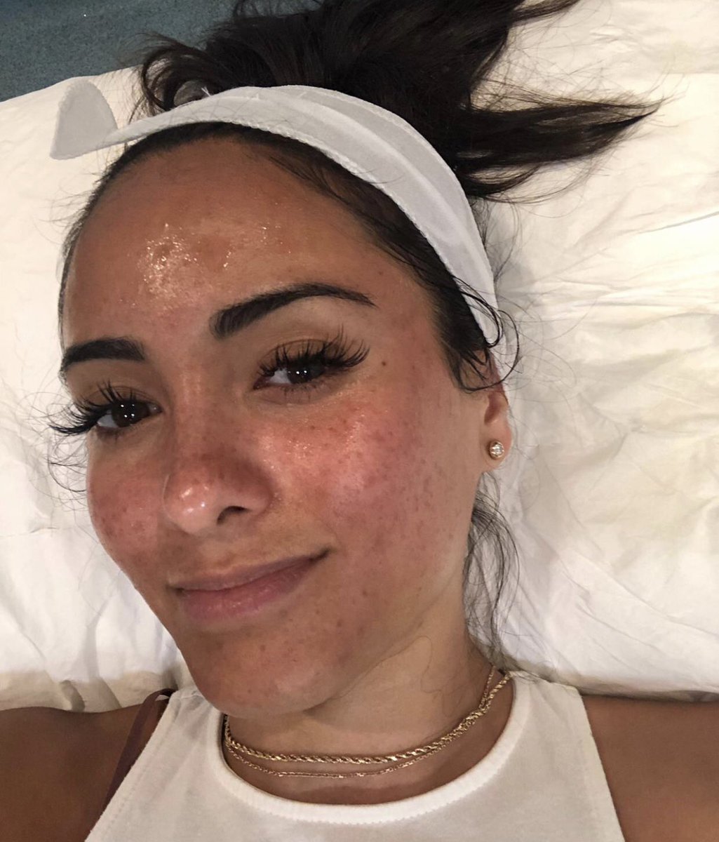 mayfairpractice's tweet photo. Living for this post #HydraFacial and #AloeVeraMask Glow 🔥 

https://t.co/fH60MPJfue https://t.co/BShv2PKIcF