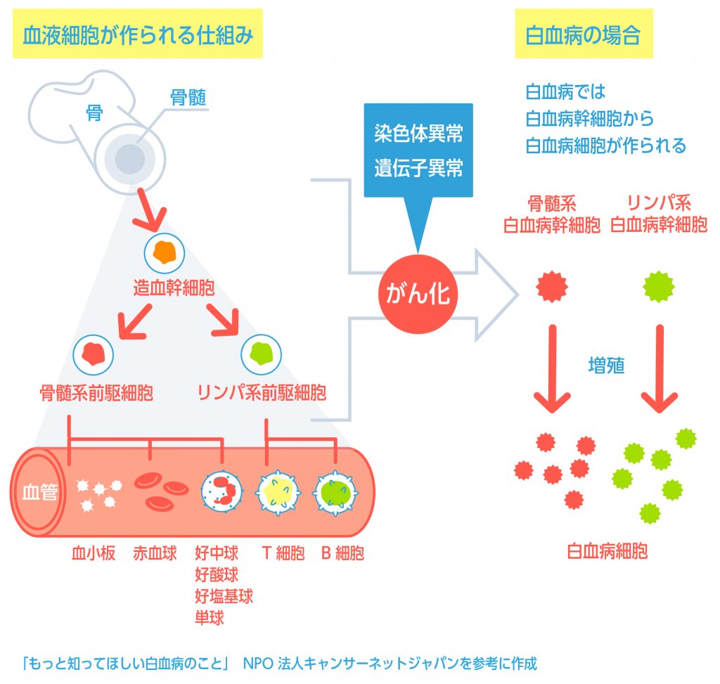 わび さび On Twitter 白血病を知る ざっくり簡易版 血液型 Abo式血液型で輸血が可能 白血病 Hla型 ヒト白血球型抗原 赤血球の型と比較ならず 数万通り 両親から半分ずつ遺伝なので適合せず 兄弟間で25 非血縁 数百 数万分の1 骨髄バンクやドナー