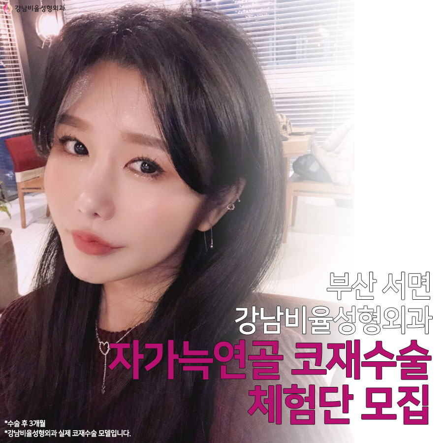 코재수술을 고민하지만 비용으로
부담이 된다면?

전화 및 카톡 문의 : 010-7359-3700
부산 서면역 7번출구
판도라 건물 12층
doctorface.co.kr

#부산성형외과 #서면성형외과 #부산성형외과모델 #부산성형외과이벤트 #부산코재수술 #부산성형모델 #성형모델 #성형체험단 #성형외과모델