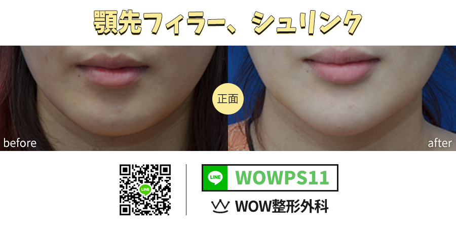 Wow整形外科 Surgerywow Twitter