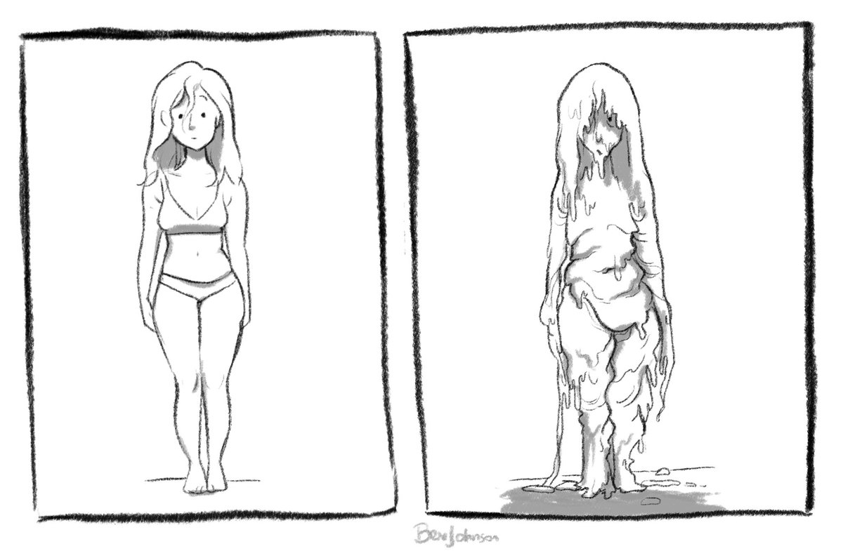 body dysmorphia 