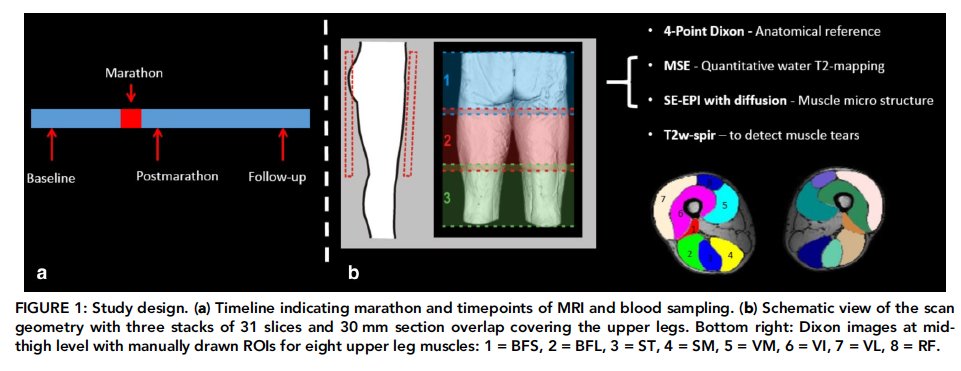 ThijsEijsvogels's tweet image. Our latest paper: Quantitative #MRI Reveals #Microstructural #Changes in the Upper #Leg Muscles After #Running a #Marathon. Open access availability via: onlinelibrary.wiley.com/doi/full/10.10…