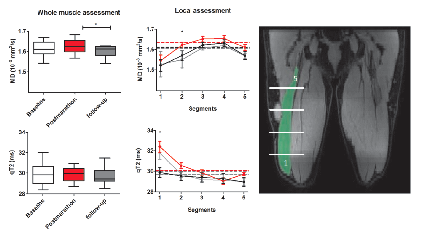 ThijsEijsvogels's tweet image. Our latest paper: Quantitative #MRI Reveals #Microstructural #Changes in the Upper #Leg Muscles After #Running a #Marathon. Open access availability via: onlinelibrary.wiley.com/doi/full/10.10…