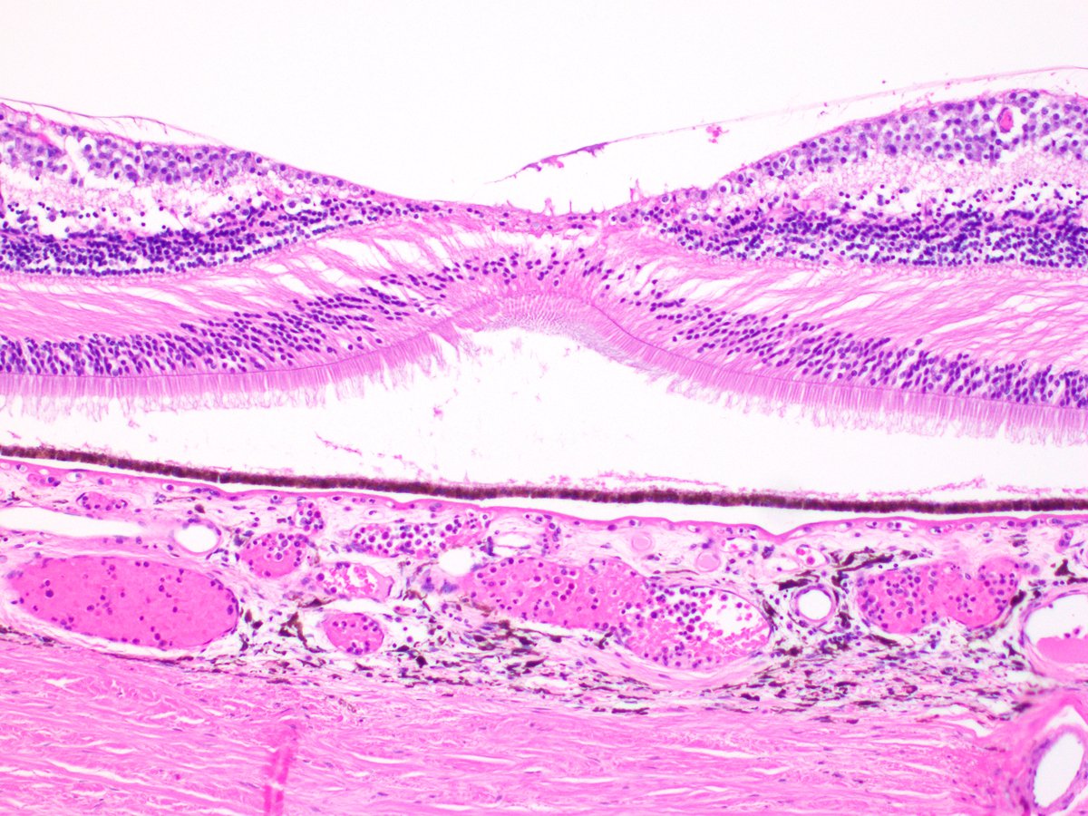 #Eyepath teaching. What is the portion of the retina in the center of the image called? What about the surrounding retina? #OKAPS