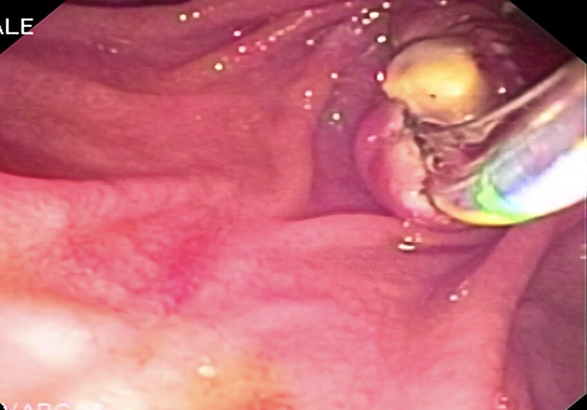 Endoscopia Gea #QuedateEnCasa tweet media