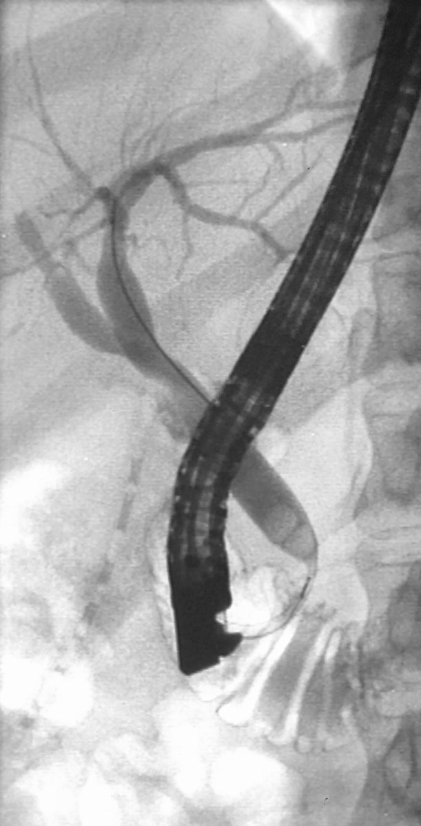 Endoscopia Gea #QuedateEnCasa tweet media