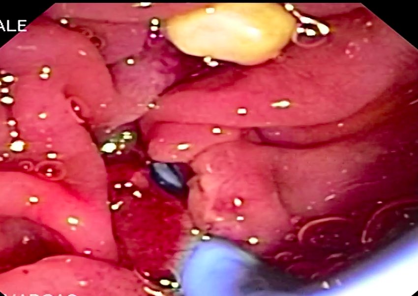 Endoscopia Gea #QuedateEnCasa tweet media