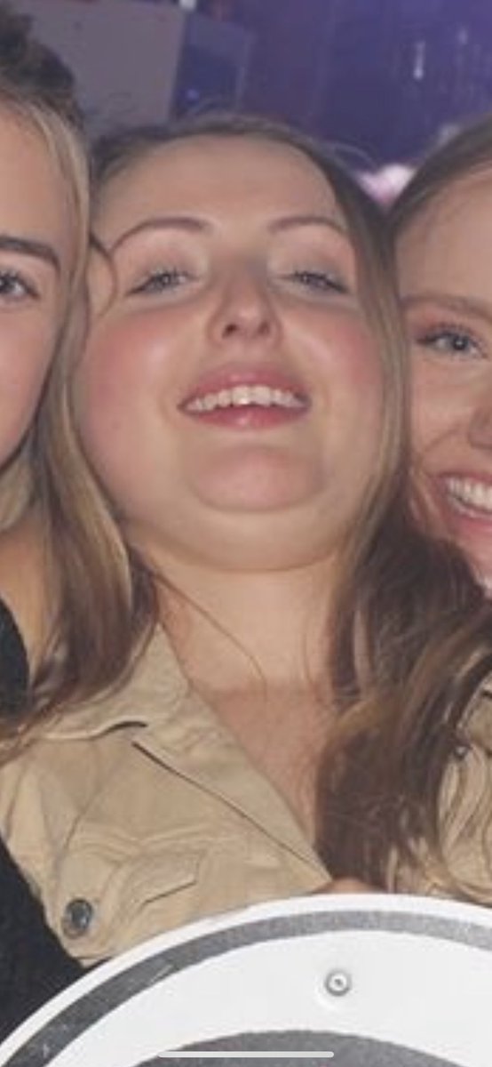 TWFitball's tweet photo. Ellie has mumps https://t.co/7mvl7dPqWn
