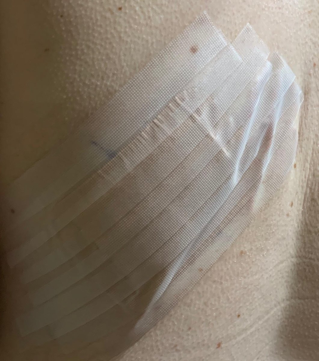 Michelle_Radio's tweet photo. Last week, I went in for #preventativesurgery. This Thursday hopefully everything will be done and I can move on. However, I want to get the message out there: PLEASE. Go get checked out once a year! Listen to my final update here: https://t.co/a7W6TwmFoN https://t.co/Eciztlx28Q