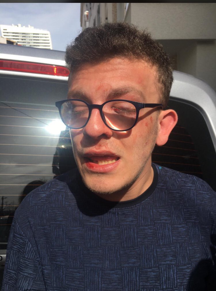 Avcılar’da, 8 Mart’ta otizmli yüzde 76 engeli bulunan 18 yaşındaki Alper Taha Behrem, yolda yürürken Okan Metin isimli şahıs tarafından, Alper’in “ben engelliyim, vurma” demesine rağmen darp edilmiş. Şüpheli gözaltı sonrası serbest bırakılmış. Ailesi seslerini duyurmak istiyor.