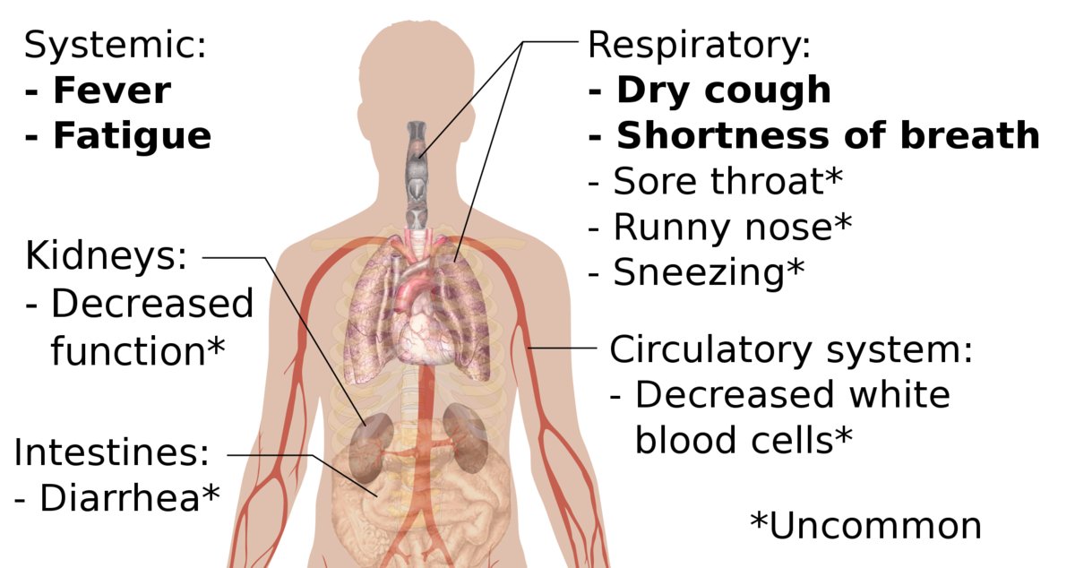 Plumbing_HVAC_'s tweet image. Health officials in Hong Kong have determined that #plumbing systems in certain high-rise buildings are implicated in recent cases of the #coronavirus. To learn how it helped spread the #virus, follow the link! 

buff.ly/2IzmEfu