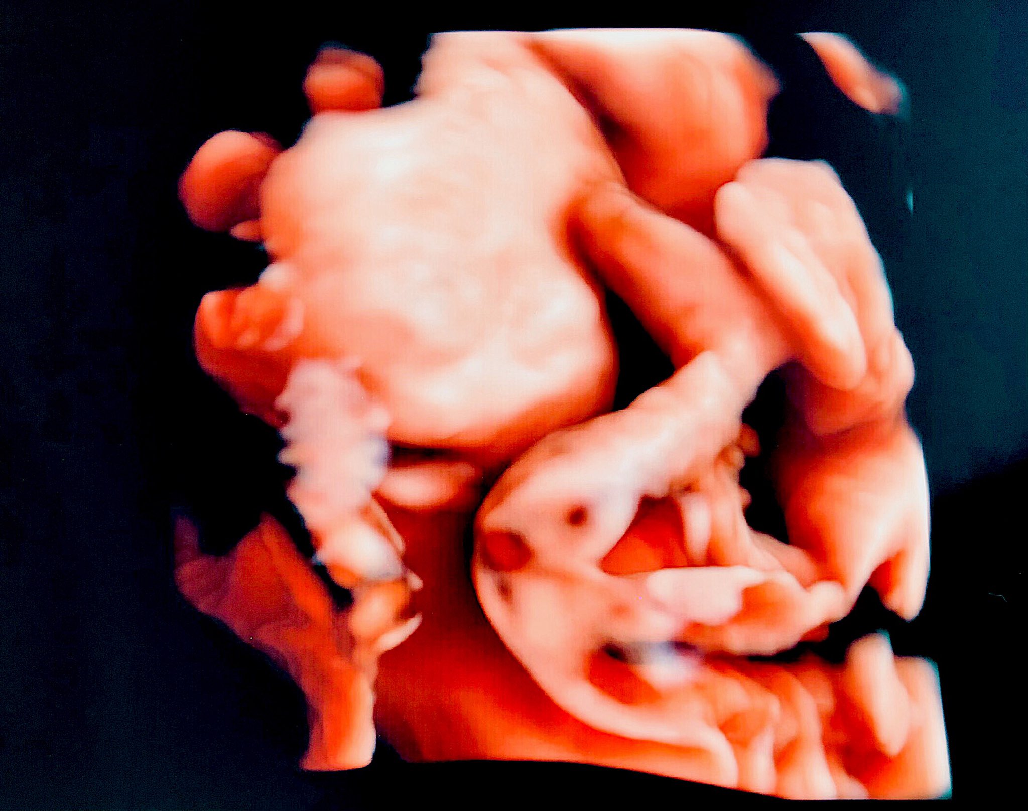 𝐌𝐄𝐋𝐎 毎日充実です 4dエコーでは最後の最後に お顔見せてくれて感動して 昨日も妊婦健診で女の子っぽいって 葉っぱさん見えたから ほとんどの確率で女の子だろうな 旦那とみゅうとお腹のbabyと みんな毎日一緒で幸せです