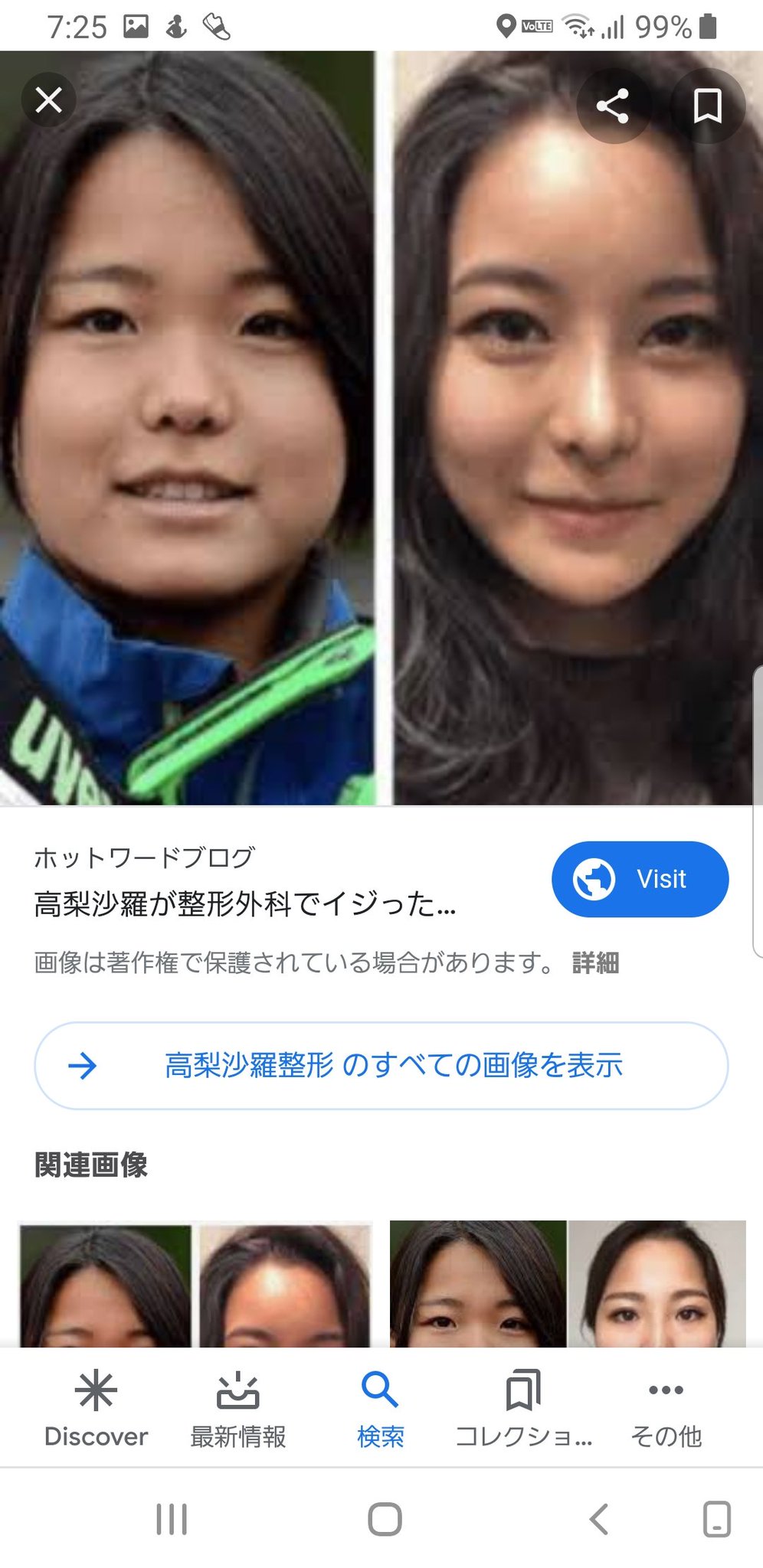 高梨 沙羅 顔
