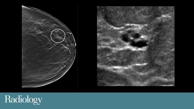 Resmi Twitter'da görüntüle
