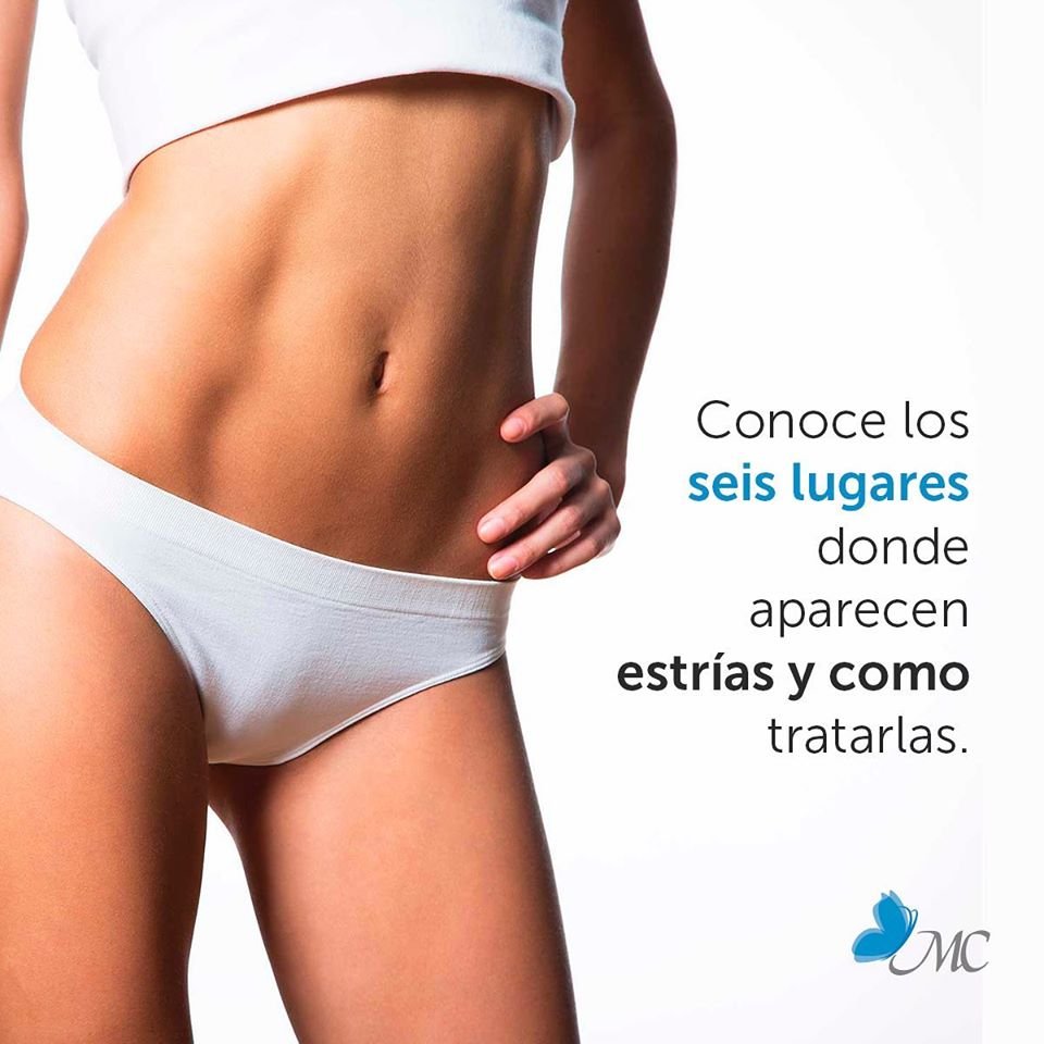 mariacabarcasc's tweet photo. ⁣
Las estrías generalmente suelen aparecer en los senos, en la cola, en el abdomen, en la espalda, en la cadera y en los muslos.⁣
⁣
Hay diversos factores que colaboran con la aparición de las temidas estrías.⁣
Conoce mas en nuestro post de Instagram... https://t.co/nxeQWf6Rg2