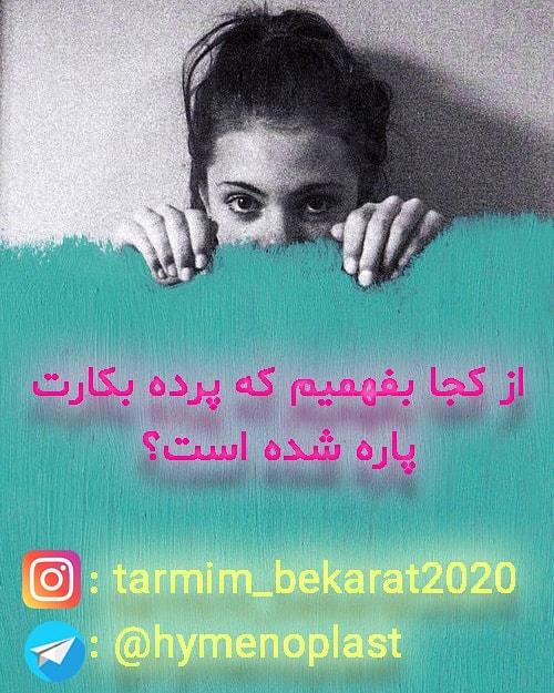 Hymenoplasty1's tweet photo. #ترمیم_پرده_بکارت با#ضمانت و #با_خونریزی،#تنگ_کردن_واژن،#لبیاپلاستی،#هایمنوپلاستی،#هایمنورافی،#واژینوپلاستی ، #بدون_درد زیر نظر #متخصص_زنان هم اکنون با ما تماس بگیرید https://t.co/e7nOxB3bDK