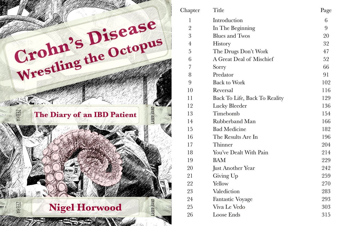 Crohnoid's tweet photo. Yes, I really have finished my book and it is freely available to download in pdf format. It charts my 40+ years of #IBD #crohns treatment under the #NHS. To get your copy go to the link at the bottom of this page - https://t.co/8hhl48IKQ1 https://t.co/ZMGPoMKDOZ