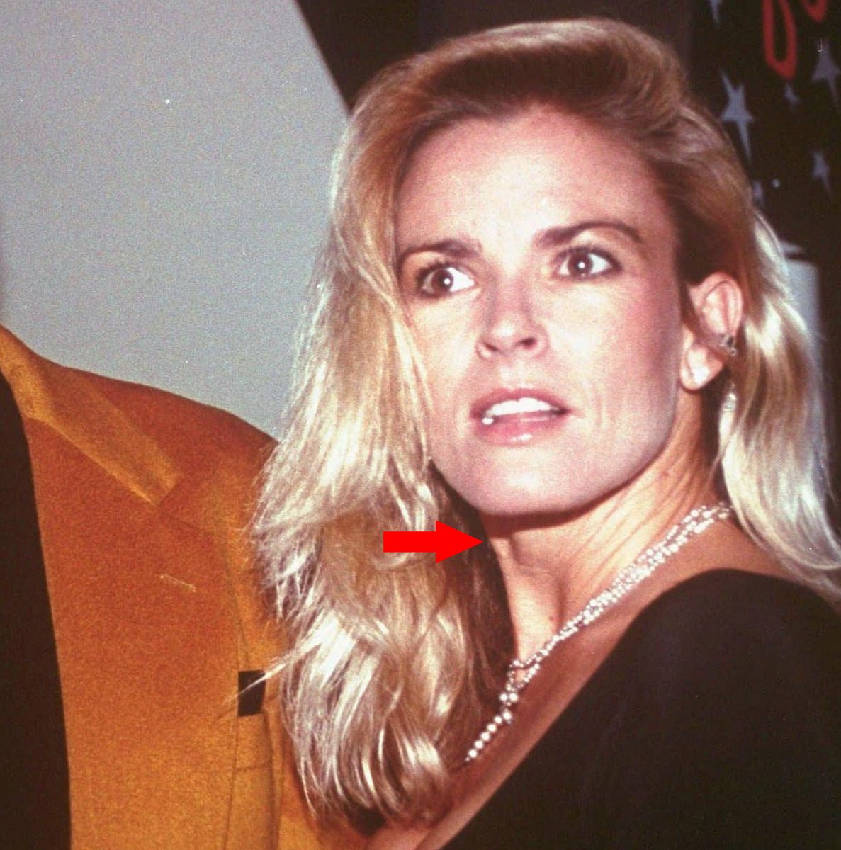 Do you think these photos of Nicole Simpson show she had an Adam's app...