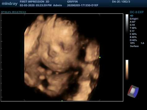 gracefulwings78's tweet photo. My grandbaby is due next month and I'm so excited about her arrival. Thea Marie  Griffin 💝🤱🥰🌸 https://t.co/LJbGUXcaGs