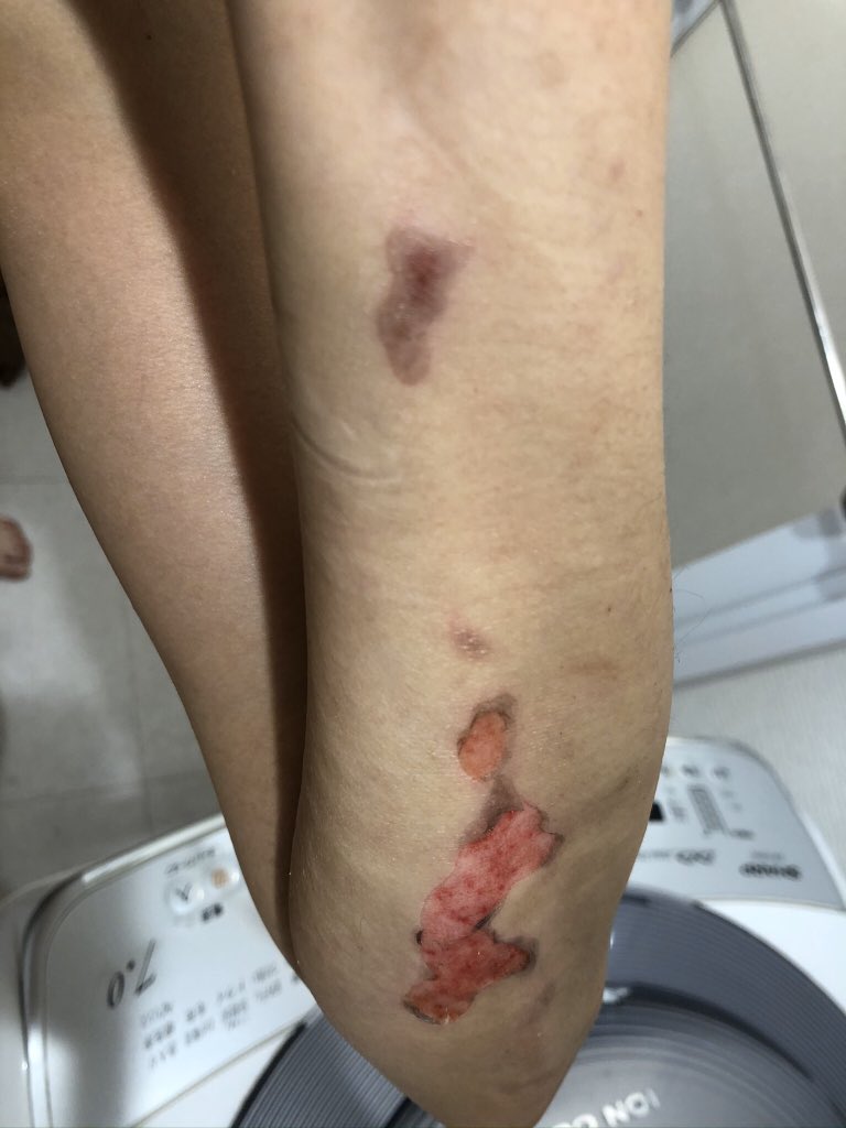 高橋ちなり 病気