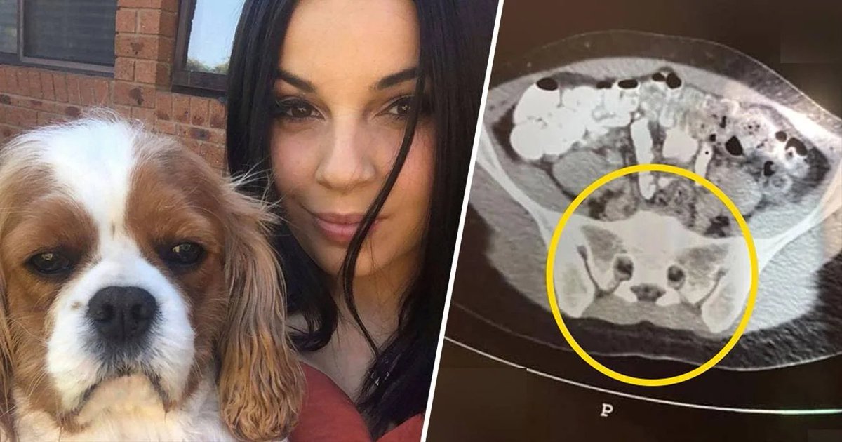 tobytarrant's tweet photo. Here it is, as promised.

A lady who spotted her dog 'George' in her pelvic CT scan: https://t.co/s1NrawXPaI
