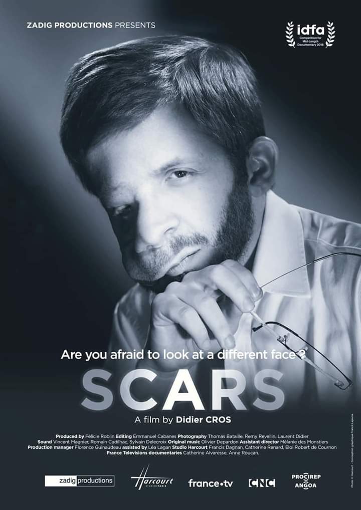 salefran's tweet photo. Avant-première de Scars - La Disgrâce @Scars_doc
de Didier Cros, ce soir au @maxlinderpano par @zadigproduction @FRoblin
Documentaire le 24 mars sur @France2tv dans l’émission Infrarouge a 23h40, et ensuite en replay pendant 3 semaines. #Scars #Disgrace #faces #destroyed #visuel https://t.co/F8V25OQFK2