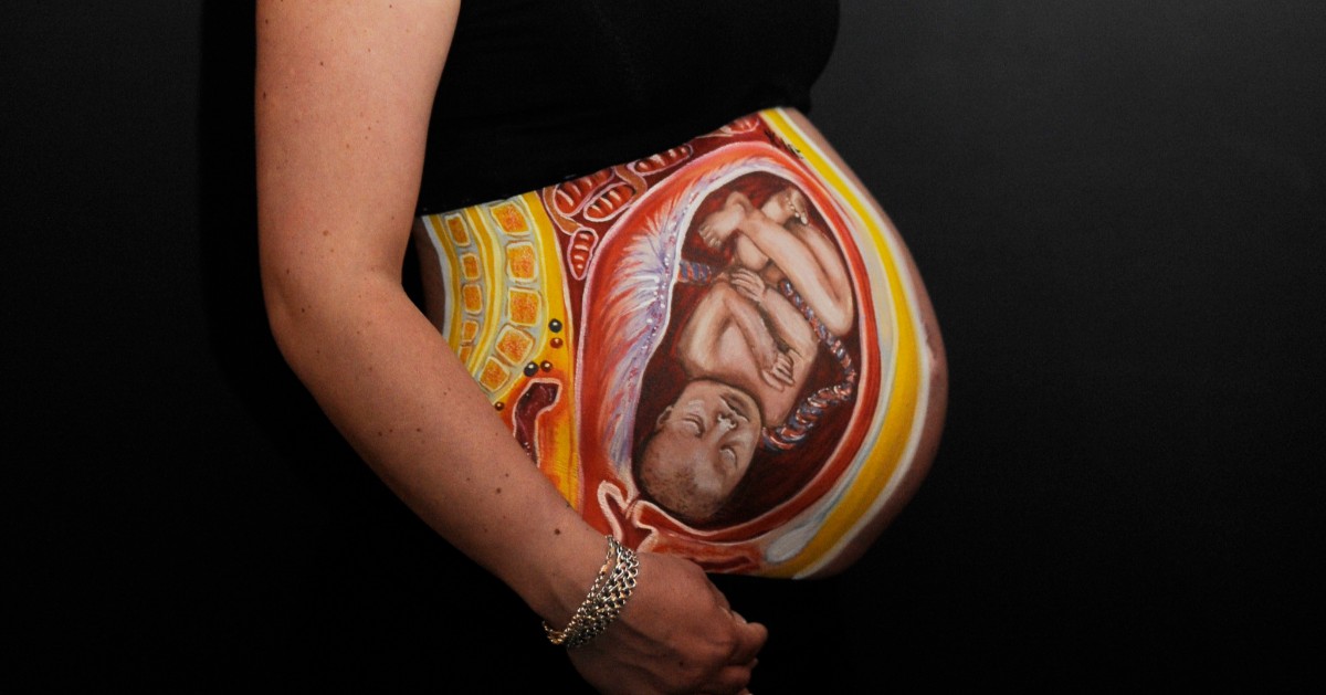 Body Worlds London tweet media