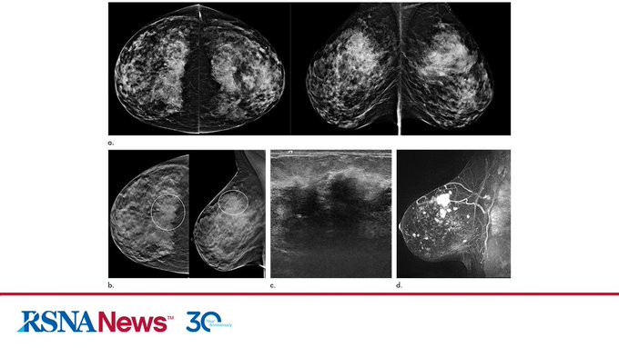 Resmi Twitter'da görüntüle