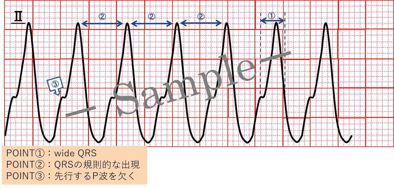 心室頻拍 Twitter Search Twitter