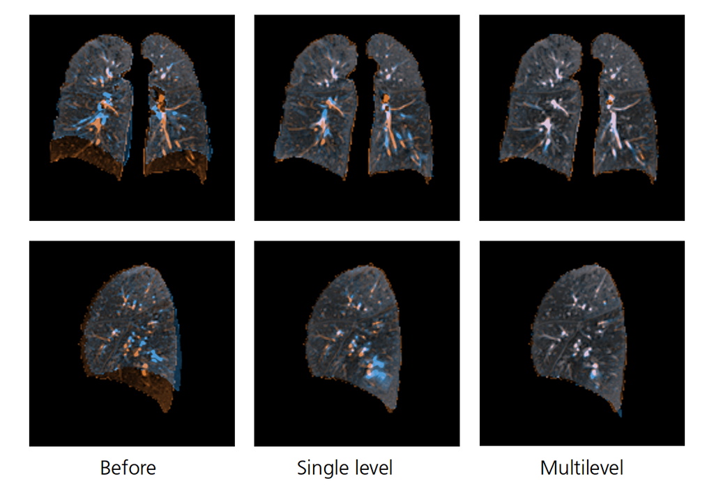 FraunhoferMEVIS's tweet photo. Improving image registration by a multilevel Deep Learning approach: find out more in our talk at @BVM_workshop 2020 in #Berlin. https://t.co/L616cqX0CA #AI #DeepLearning #ImageRegistration #BVM2020 https://t.co/BAYjnOi2wx