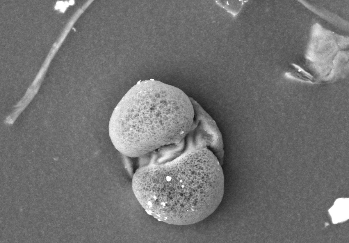 britishmuseum's tweet photo. This is what dust looks like under the microscope! 🔬 #BSW20

Can you match the images to the samples found in the Museum? 👀

Can you identify:

A feather 

A cotton fibre 

Pollen

Skin https://t.co/7SipQ1VVPk
