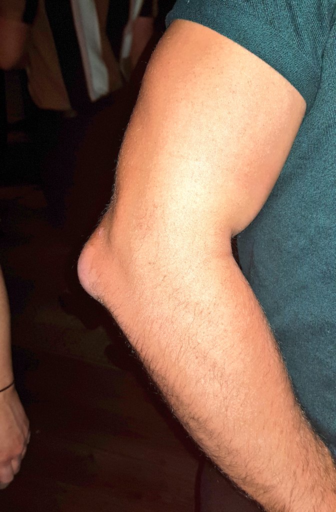 jd_mcdonagh's tweet photo. I for one can't wait to go back to shaking 100+ hands at wrestling shows, all this elbow-bumping business has me in bits! 😷 https://t.co/mUd5dQDLeZ